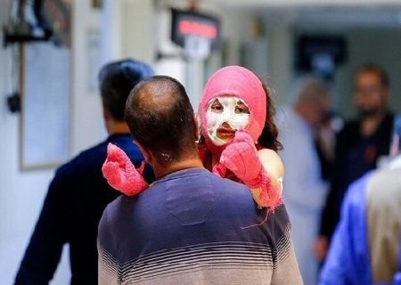  ۱۹۲ مصدوم و ۳ قطع عضو در چهارشنبه‌سوری همدان