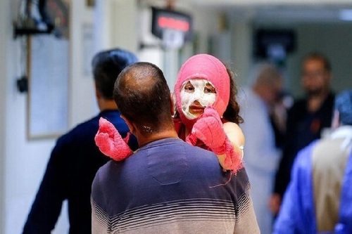  ۱۹۲ مصدوم و ۳ قطع عضو در چهارشنبه‌سوری همدان